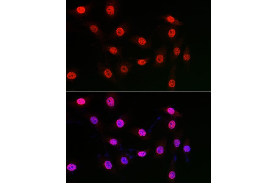 Immunofluorescence - Anti-WDR46 Antibody (A305665) - Antibodies.com