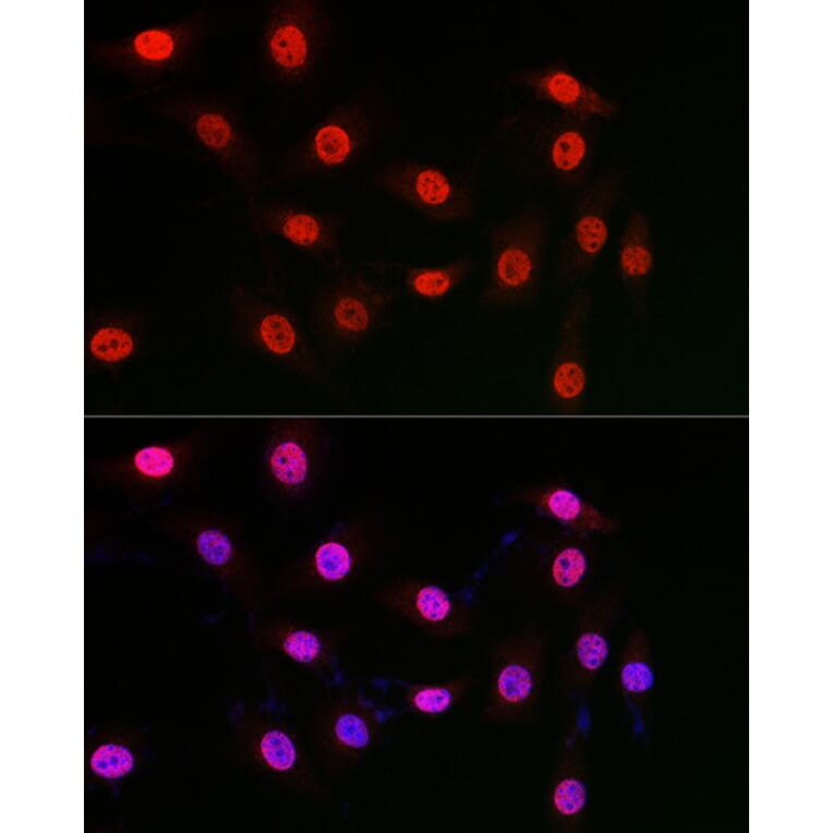 Immunofluorescence - Anti-WDR46 Antibody (A305665) - Antibodies.com