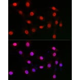 Immunofluorescence - Anti-WDR46 Antibody (A305665) - Antibodies.com