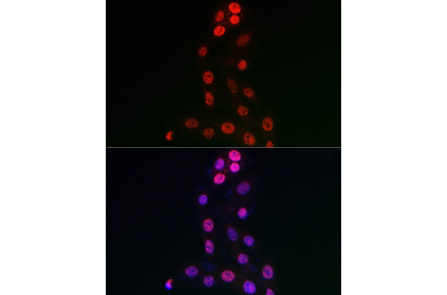 Immunofluorescence - Anti-WDR46 Antibody (A305665) - Antibodies.com
