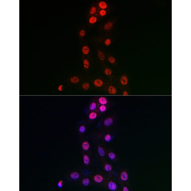 Immunofluorescence - Anti-WDR46 Antibody (A305665) - Antibodies.com
