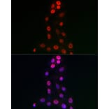 Immunofluorescence - Anti-WDR46 Antibody (A305665) - Antibodies.com