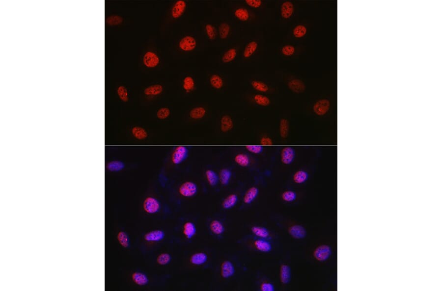 Immunofluorescence - Anti-WDR46 Antibody (A305665) - Antibodies.com
