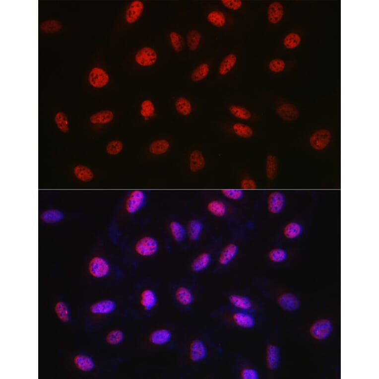 Immunofluorescence - Anti-WDR46 Antibody (A305665) - Antibodies.com
