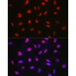 Immunofluorescence - Anti-WDR46 Antibody (A305665) - Antibodies.com