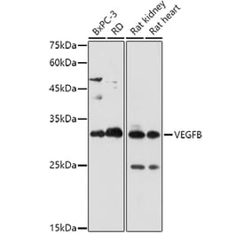 Western Blot - Anti-VEGFB Antibody (A305667) - Antibodies.com