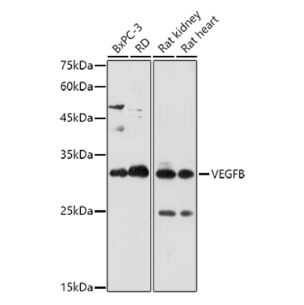 Western Blot - Anti-VEGFB Antibody (A305667) - Antibodies.com