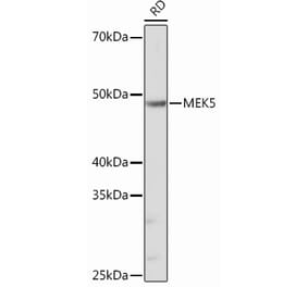 Western Blot - Anti-MEK5 Antibody [ARC0711] (A305668) - Antibodies.com