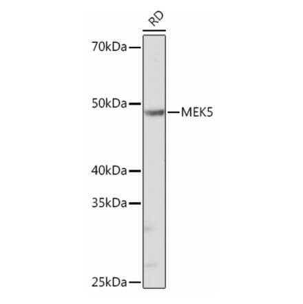 Western Blot - Anti-MEK5 Antibody [ARC0711] (A305668) - Antibodies.com