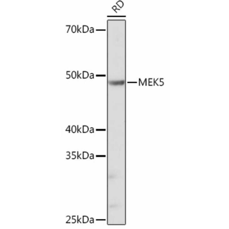 Western Blot - Anti-MEK5 Antibody [ARC0711] (A305668) - Antibodies.com