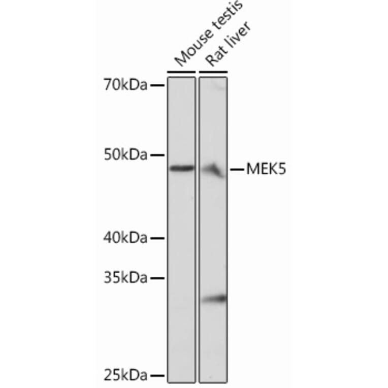 Western Blot - Anti-MEK5 Antibody [ARC0711] (A305668) - Antibodies.com