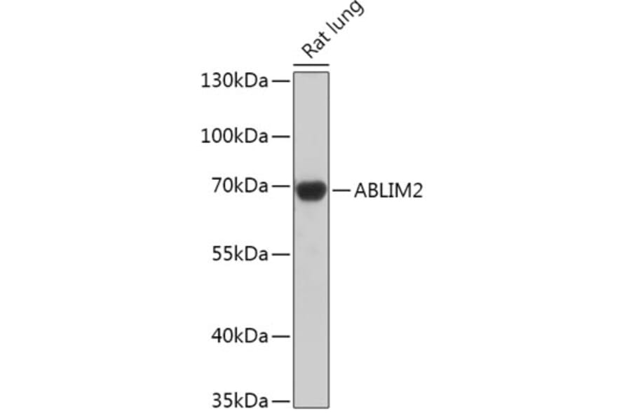 Western Blot - Anti-ABLIM2 Antibody (A305671) - Antibodies.com