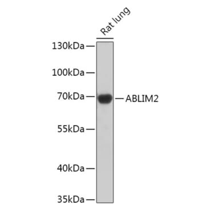 Western Blot - Anti-ABLIM2 Antibody (A305671) - Antibodies.com