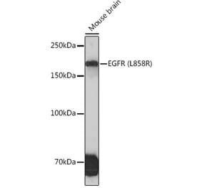 Western Blot - Anti-EGFR Antibody [ARC1139] (A305672) - Antibodies.com