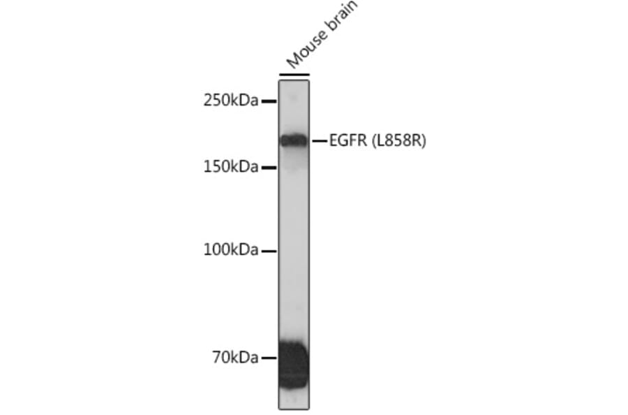 Western Blot - Anti-EGFR Antibody [ARC1139] (A305672) - Antibodies.com