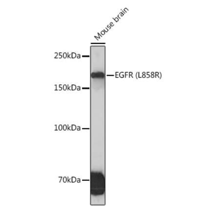 Western Blot - Anti-EGFR Antibody [ARC1139] (A305672) - Antibodies.com
