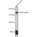 Western Blot - Anti-EGFR Antibody [ARC1139] (A305672) - Antibodies.com