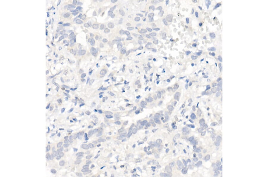 Immunohistochemistry - Anti-EGFR Antibody [ARC1139] (A305672) - Antibodies.com