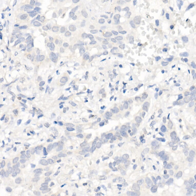 Immunohistochemistry - Anti-EGFR Antibody [ARC1139] (A305672) - Antibodies.com