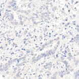 Immunohistochemistry - Anti-EGFR Antibody [ARC1139] (A305672) - Antibodies.com