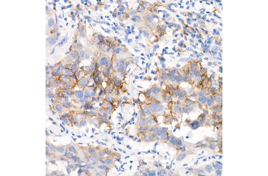 Immunohistochemistry - Anti-EGFR Antibody [ARC1139] (A305672) - Antibodies.com