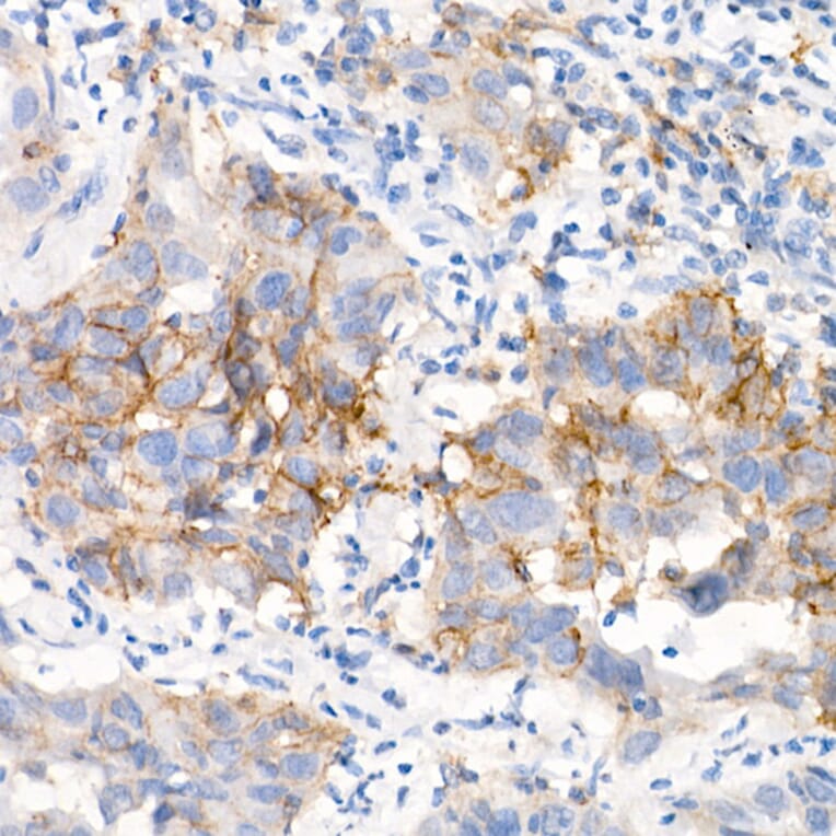 Immunohistochemistry - Anti-EGFR Antibody [ARC1139] (A305672) - Antibodies.com