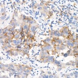 Immunohistochemistry - Anti-EGFR Antibody [ARC1139] (A305672) - Antibodies.com