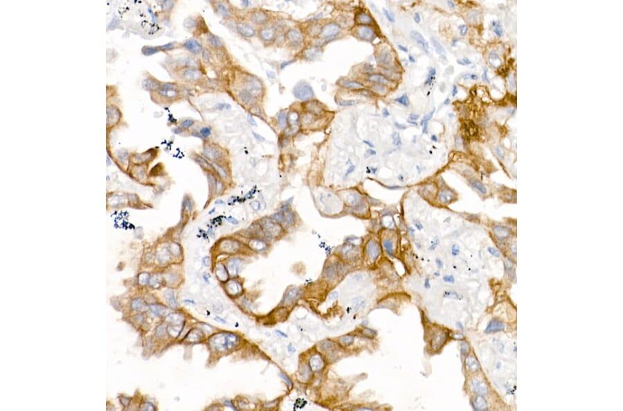 Immunohistochemistry - Anti-EGFR Antibody [ARC1139] (A305672) - Antibodies.com