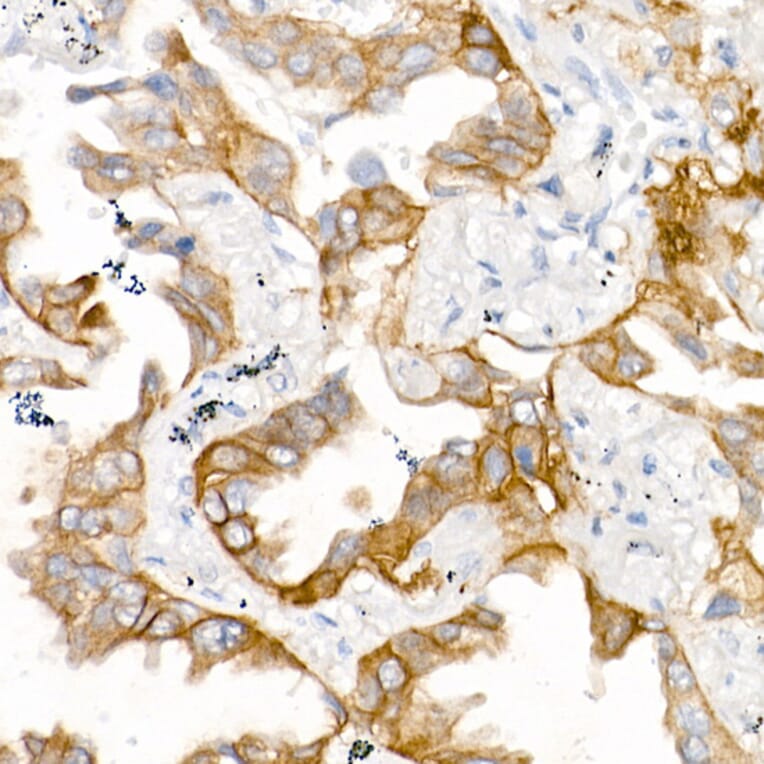 Immunohistochemistry - Anti-EGFR Antibody [ARC1139] (A305672) - Antibodies.com