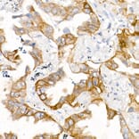 Immunohistochemistry - Anti-EGFR Antibody [ARC1139] (A305672) - Antibodies.com
