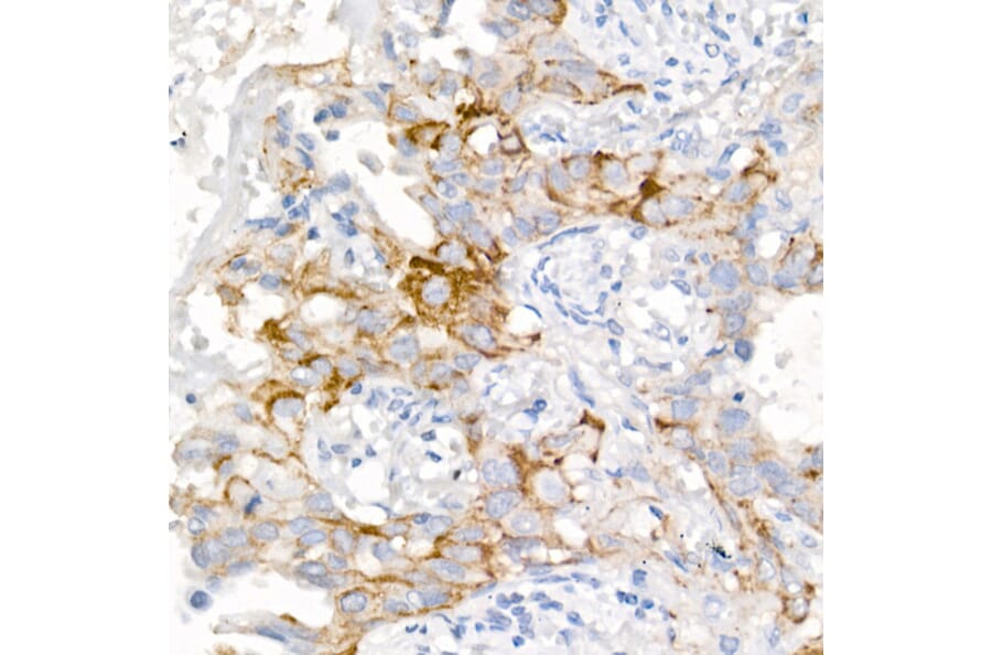 Immunohistochemistry - Anti-EGFR Antibody [ARC1139] (A305672) - Antibodies.com