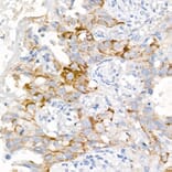 Immunohistochemistry - Anti-EGFR Antibody [ARC1139] (A305672) - Antibodies.com