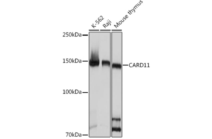 Western Blot - Anti-Carma 1/CARD11 Antibody [ARC1680] (A305673) - Antibodies.com
