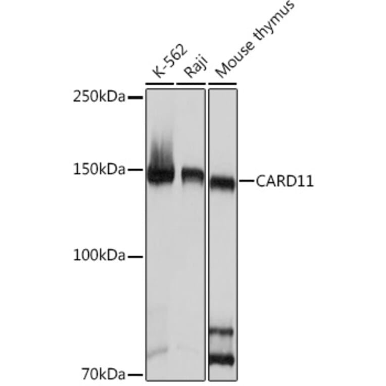 Western Blot - Anti-Carma 1/CARD11 Antibody [ARC1680] (A305673) - Antibodies.com