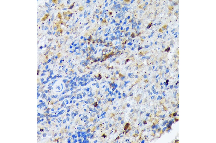 Immunohistochemistry - Anti-Carma 1/CARD11 Antibody [ARC1680] (A305673) - Antibodies.com