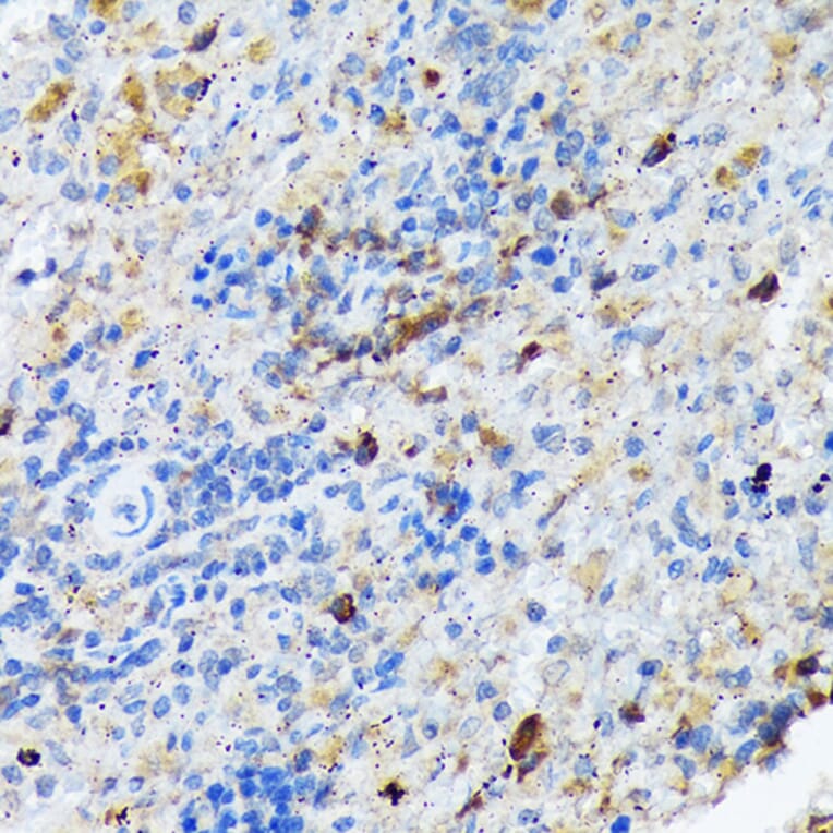 Immunohistochemistry - Anti-Carma 1/CARD11 Antibody [ARC1680] (A305673) - Antibodies.com