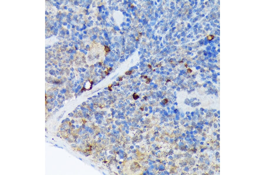 Immunohistochemistry - Anti-Carma 1/CARD11 Antibody [ARC1680] (A305673) - Antibodies.com