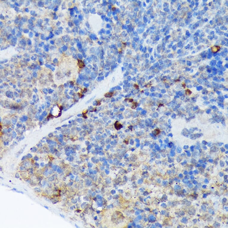 Immunohistochemistry - Anti-Carma 1/CARD11 Antibody [ARC1680] (A305673) - Antibodies.com