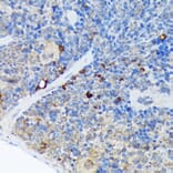 Immunohistochemistry - Anti-Carma 1/CARD11 Antibody [ARC1680] (A305673) - Antibodies.com