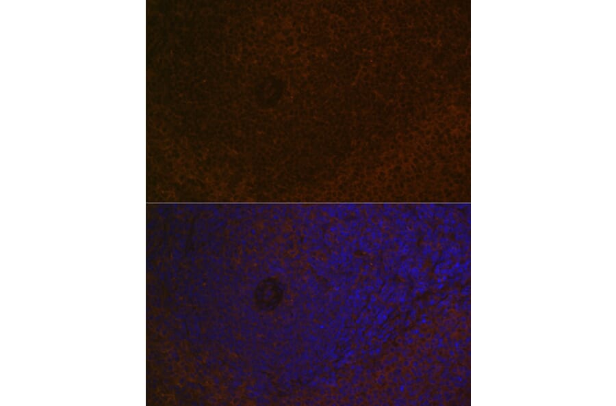 Immunofluorescence - Anti-Carma 1/CARD11 Antibody [ARC1680] (A305673) - Antibodies.com