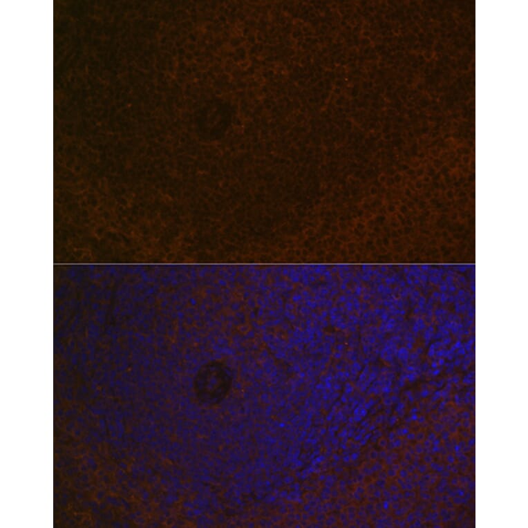 Immunofluorescence - Anti-Carma 1/CARD11 Antibody [ARC1680] (A305673) - Antibodies.com