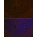Immunofluorescence - Anti-Carma 1/CARD11 Antibody [ARC1680] (A305673) - Antibodies.com