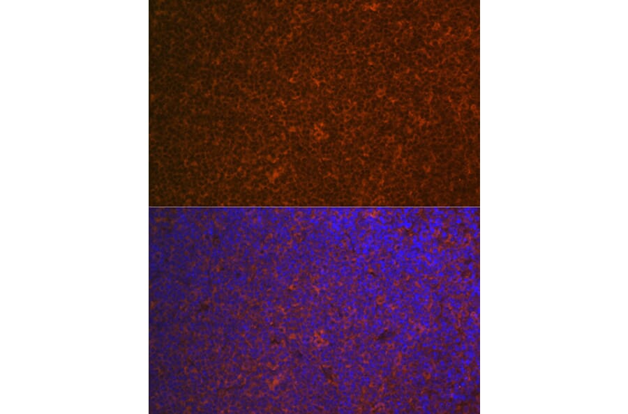 Immunofluorescence - Anti-Carma 1/CARD11 Antibody [ARC1680] (A305673) - Antibodies.com