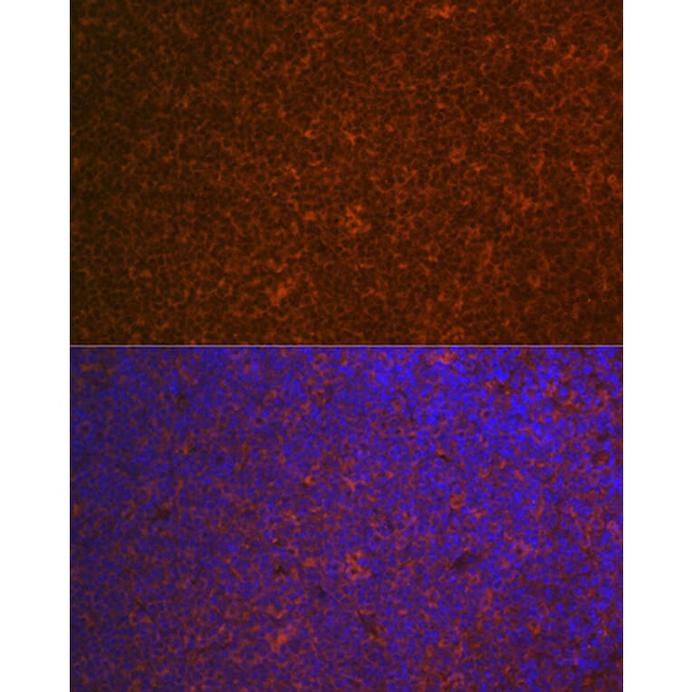 Immunofluorescence - Anti-Carma 1/CARD11 Antibody [ARC1680] (A305673) - Antibodies.com