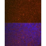 Immunofluorescence - Anti-Carma 1/CARD11 Antibody [ARC1680] (A305673) - Antibodies.com