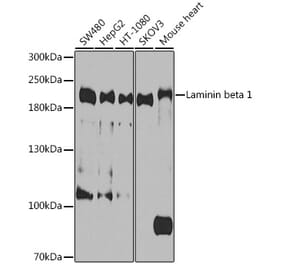 Western Blot - Anti-Laminin beta 1 Antibody (A305674) - Antibodies.com