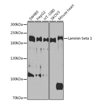 Western Blot - Anti-Laminin beta 1 Antibody (A305674) - Antibodies.com