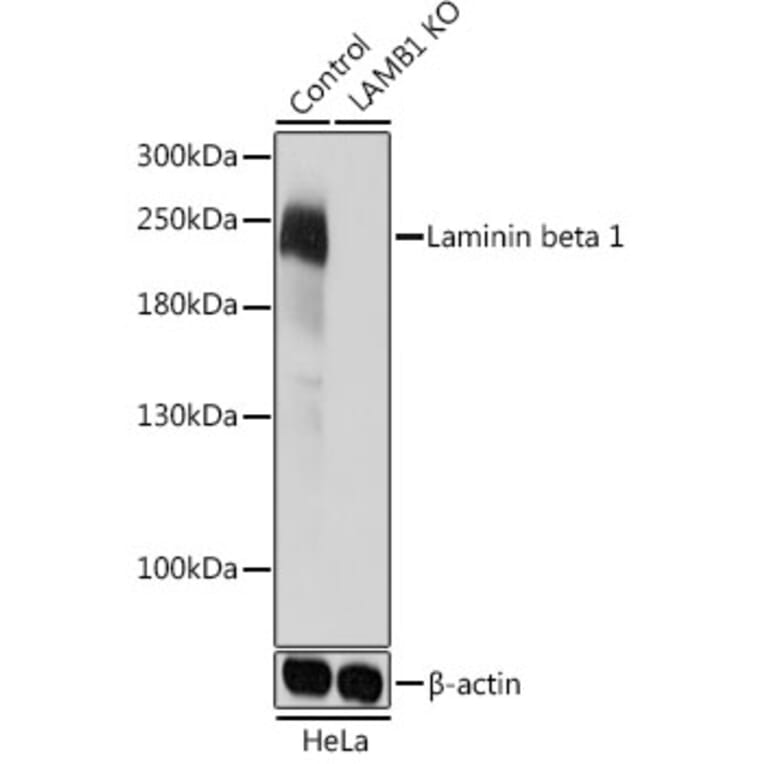 Western Blot - Anti-Laminin beta 1 Antibody (A305675) - Antibodies.com