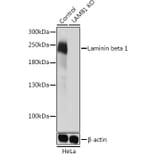 Western Blot - Anti-Laminin beta 1 Antibody (A305675) - Antibodies.com