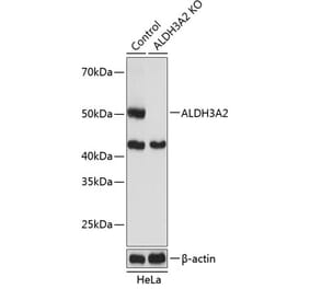 Western Blot - Anti-Aldehyde dehydrogenase 10 Antibody (A305676) - Antibodies.com